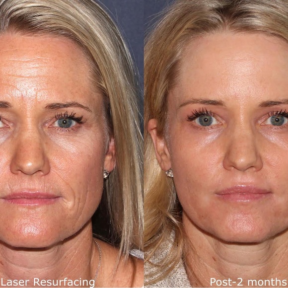 Shani Darden by Déesse PRO LED Light Mask FDA approved 
LED Light Therapy mask - Picture 10 of 12